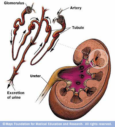  Nephrotic_Syndrome (5).jpg